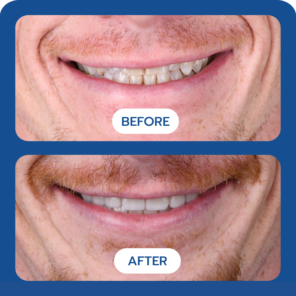 Before and After Case 8